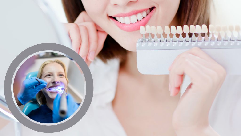 Understanding the Demand for Teeth Whitening Services
