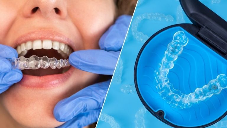 Complete guide to properly cleaning and maintaining Invisalign aligners