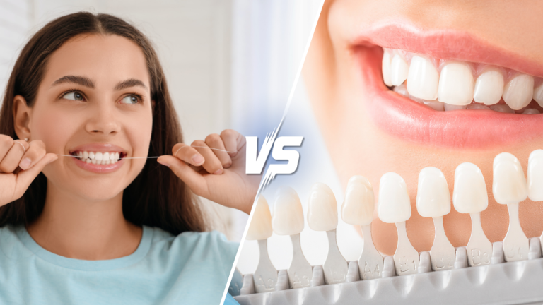 Veneers vs Whitening Which Smile Upgrade Is Right for You