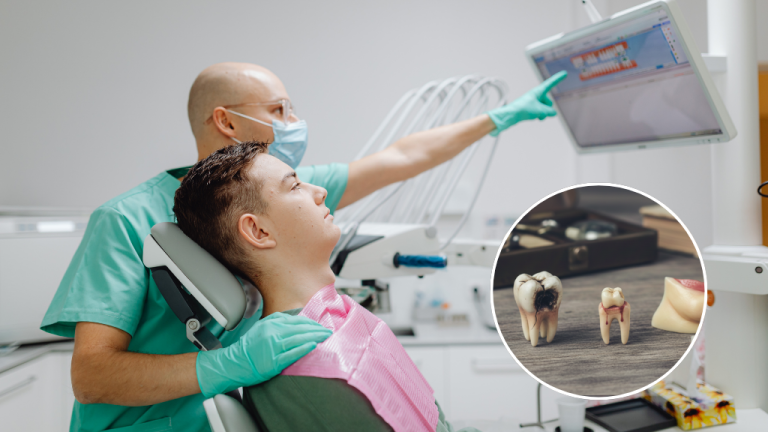 Dentist wearing gloves and mask shows dental X-ray results to a patient in a dental chair, with an inset image illustrating tooth decay stages and damaged teeth.