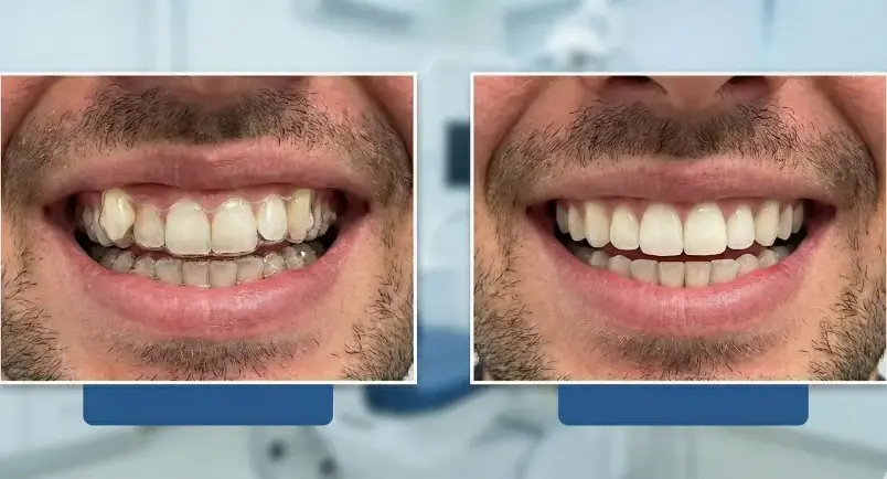 Before-and-after comparison of the treatment.